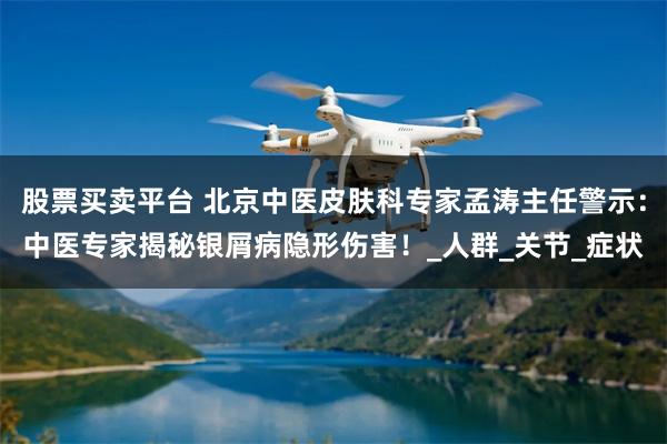 股票买卖平台 北京中医皮肤科专家孟涛主任警示：中医专家揭秘银屑病隐形伤害！_人群_关节_症状